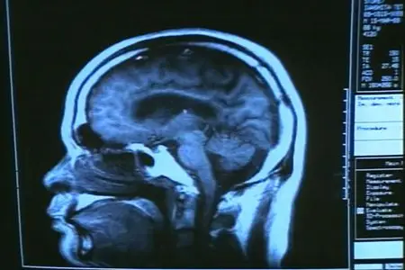 Discovery Channel - The Brain Our Universe Within: Perception (1998)