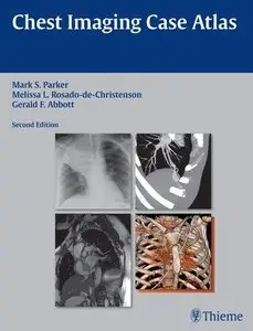 Chest Imaging Case Atlas (2nd edition) (Repost)