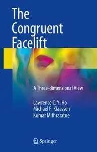 The Congruent Facelift: A Three-dimensional View