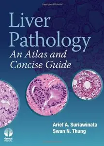 Liver Pathology: An Atlas and Concise Guide