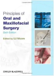 Principles of Oral and Maxillofacial Surgery (6th edition)