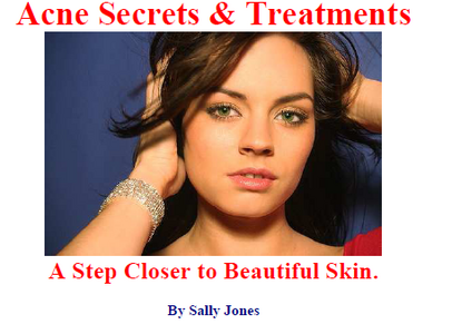 Acne Secrets and Treatments