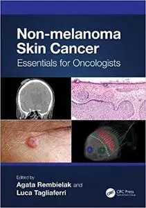 Non-melanoma Skin Cancer: Essentials for Oncologists