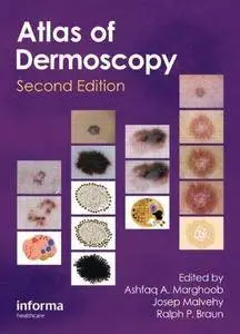 An Atlas of Dermoscopy (2nd edition) (Repost)