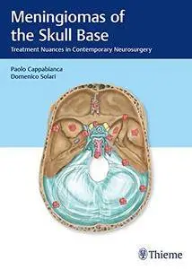 Meningiomas of the Skull Base: Treatment Nuances in Contemporary Neurosurgery