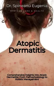 Comprehensive Insights into Atopic Dermatitis: From Pathophysiology to Holistic Management