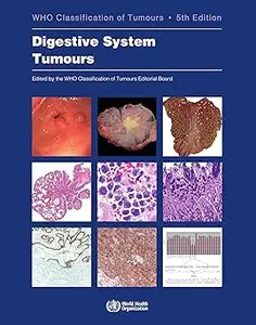 Digestive System Tumours: WHO Classification of Tumours