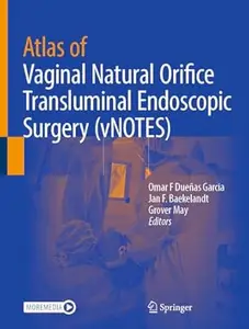 Atlas of Vaginal Natural Orifice Transluminal Endoscopic Surgery (vNOTES)