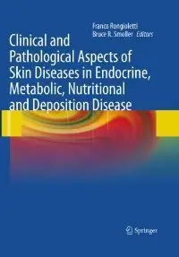 Clinical and Pathological Aspects of Skin Diseases in Endocrine, Metabolic, Nutritional and Deposition Disease (repost)