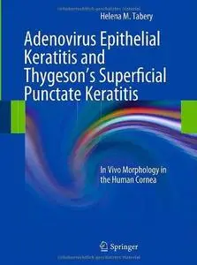 Adenovirus Epithelial Keratitis and Thygeson's Superficial Punctate Keratitis: In Vivo Morphology in the Human Cornea