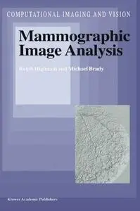 Mammographic Image Analysis