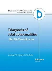 Diagnosis of Fetal Abnormalities: The 18-23-Week Scan by K.H. Nicolaides