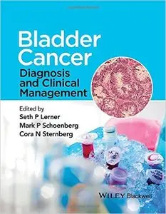 Bladder Cancer: Diagnosis and Clinical Management (repost)