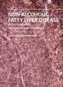 "Non-Alcoholic Fatty Liver Disease: Molecular Bases, Prevention and Treatment" ed. by Rodrigo Valenzuela