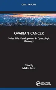 Ovarian Cancer