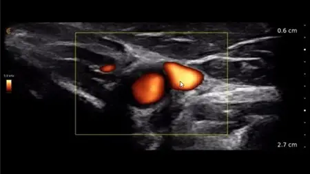Ultrasound Physics + Instrumentation Review For Spi Or Rmsk