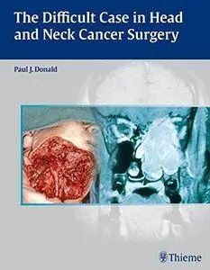 The Difficult Case in Head and Neck Cancer Surgery