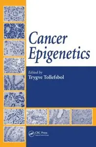 Cancer Epigenetics (repost)