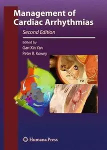 Management of cardiac arrhythmias