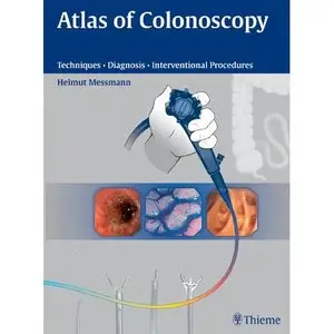 Atlas of Colonoscopy: Examination Techniques and Diagnosis (repost)