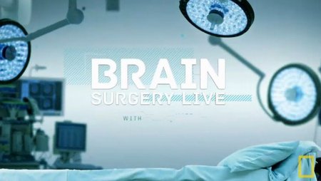 National Geographic - Brain Surgery Live With Mental Floss (2015)