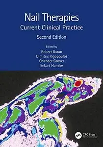 Nail Therapies: Current Clinical Practice, 2nd Edition