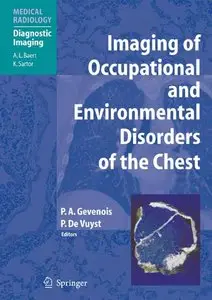Imaging of Occupational and Environmental Disorders of the Chest by Pierre Alain