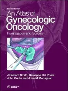 Atlas of Gynecologic Oncology, 2nd Edition by J. Richard Smith