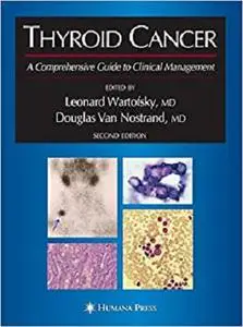 Thyroid Cancer: A Comprehensive Guide to Clinical Management