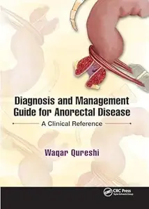 Diagnosis and Management Guide for Anorectal Disease