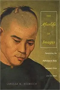 The Afterlife of Images: Translating the Pathological Body between China and the West