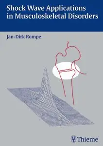 Shock Wave Applications in Musculoskeletal Disorders (repost)