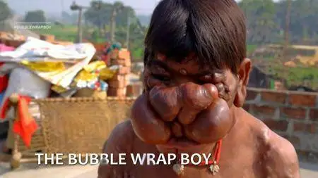 Channel 5 - Extraordinary People: The Bubble Wrap Boy (2017)