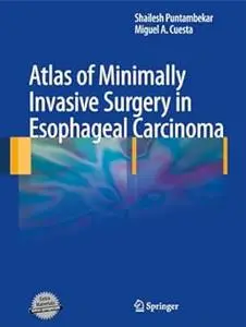 Atlas of Minimally Invasive Surgery in Esophageal Carcinoma (Repost)