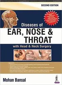 Diseases of Ear, Nose & Throat: With Head & Neck Surgery Ed 2