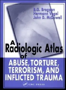 A Radiologic Atlas of Abuse, Torture, Terrorism, and Inflicted Trauma by B. G. Brogdon [Repost]