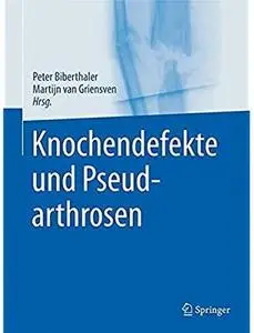 Knochendefekte und Pseudarthrosen [Repost]