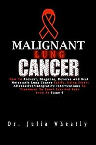 Malignant Lung Cancer