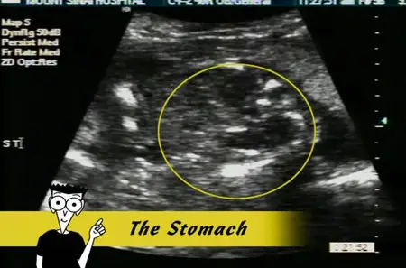 Pregnancy for Dummies