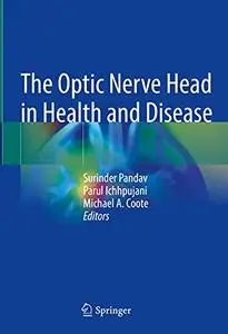 The Optic Nerve Head in Health and Disease