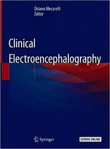 Clinical Electroencephalography (Repost)