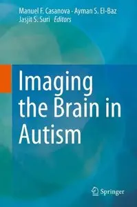 Imaging the Brain in Autism [Repost]