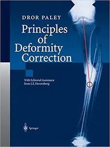 Principles of Deformity Correction (Repost)