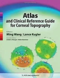 Atlas and Clinical Reference Guide for Corneal Topography (Repost)