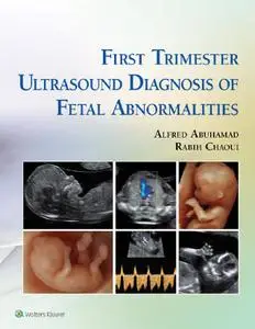 First Trimester Ultrasound Diagnosis of Fetal Abnormalities (Repost)