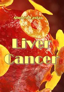 "Liver Cancer" ed. by Ahmed Lasfar