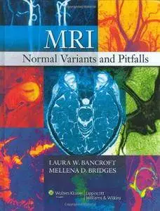 MRI Normal Variants and Pitfalls (Repost)