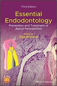 Essential Endodontology: Prevention and Treatment of Apical Periodontitis Ed 3