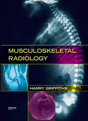Musculoskeletal Radiology