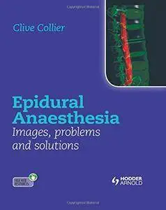 Epidural Anaesthesia: Images, Problems and Solutions(Repost)